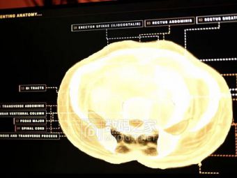Midjourney不做图改做体检了，搞了个全身超声波扫描仪还要开连锁水疗中心