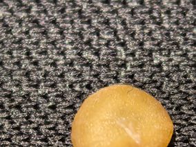 口腔里面拆出来的东西，居然发芽了，自己都不相信