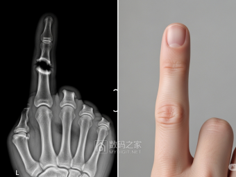 骨再生技术新突破！生物公司Bone Biologics提交靶向成骨蛋白专利​