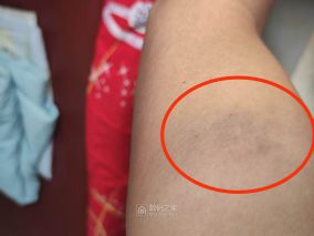 骑行偶开门杀复盘
