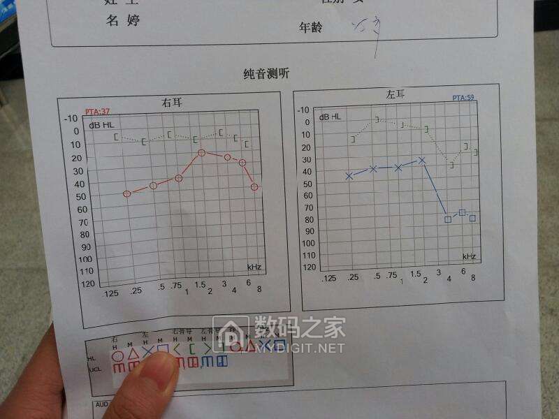 听力曲线2.jpg