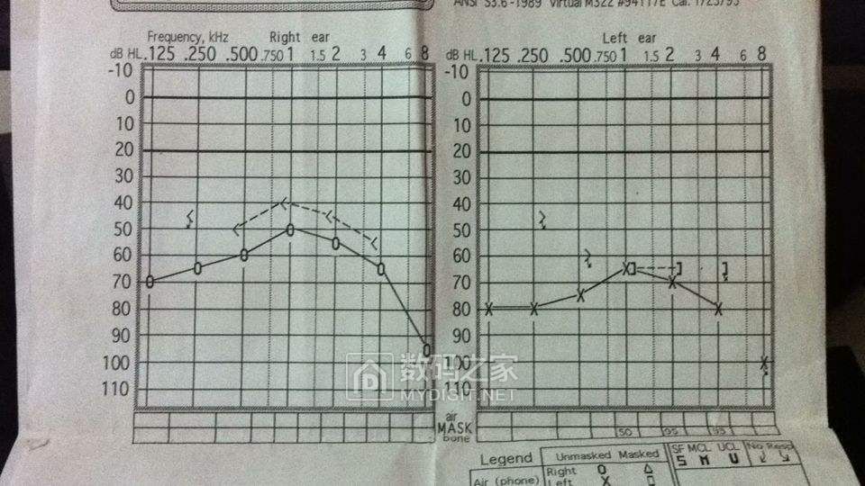 听力曲线4.jpg
