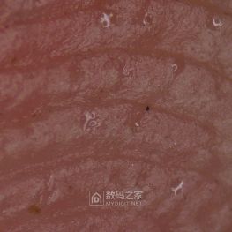 显微镜下手指上的汗腺
