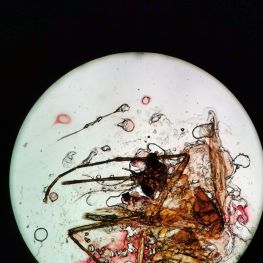 显微摄影-蚊子，生命并没有完全终结，需要为科学做出贡献